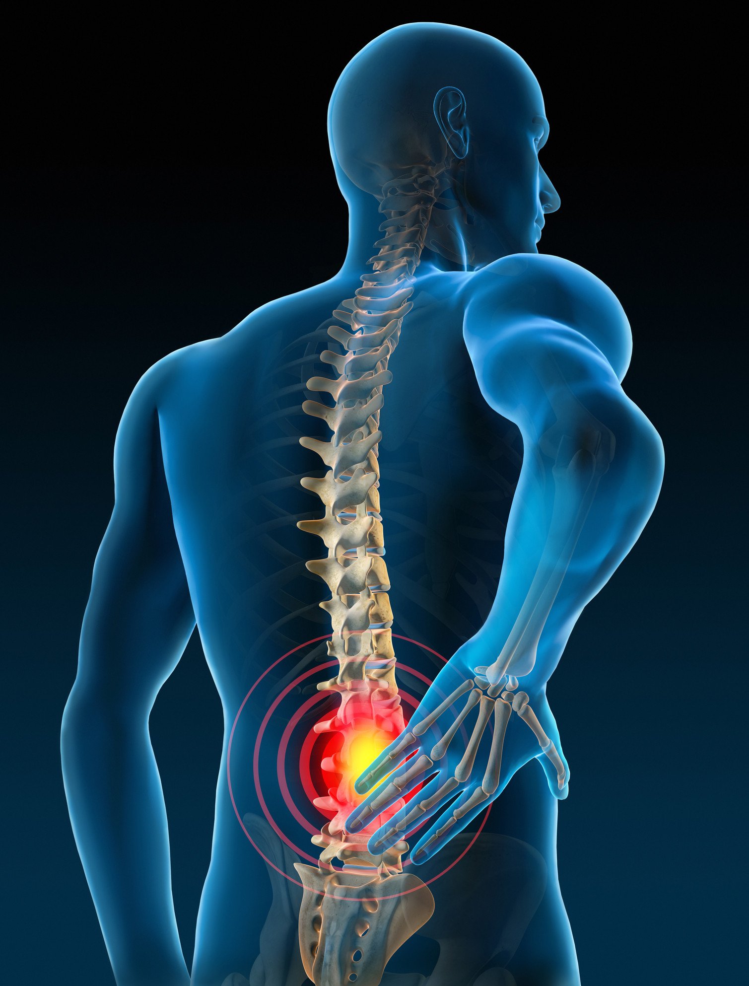 Spine procedures and treatment options in Hyderabad